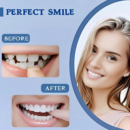 Instant Adjustable Snap-On Denture Kit | Medical-Grade Invisible Teeth for Gap Repair & Temporary Crowns