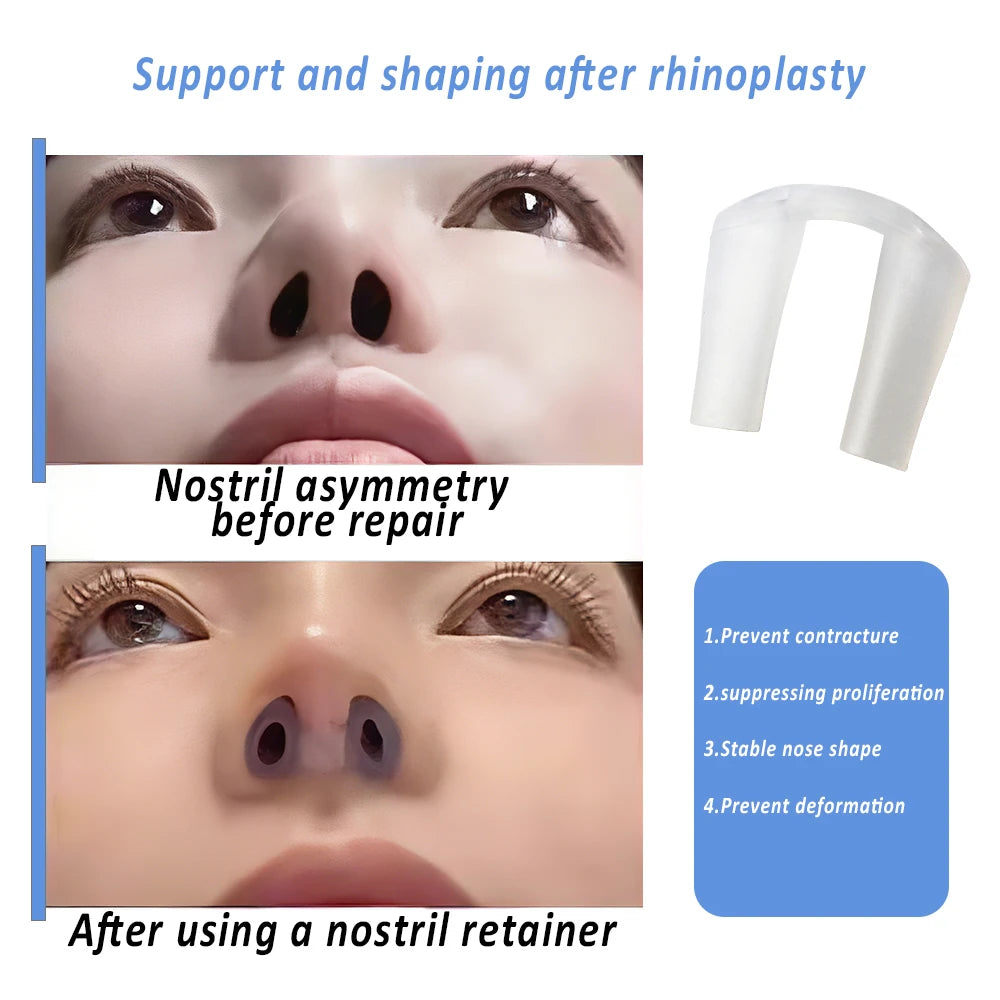 1pc Silicone Nostril Support Rhinoplasty Postoperative Nose Shaping Beauty Noseclip Nose Correction Fixator Adjust