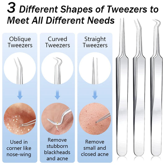 Stainless Steel Acne Blackhead Removal Needles Kit Black Spot Blemish Pimple Removal Needle Deep Cleansing Tool Face Skin Care