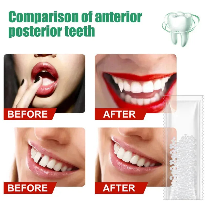 5-100g Moldable False Teeth Tooth Repair Granules Tooth Beads Temporary Filling For Rooth Broken Tooth Repair Kit Thermal Fit