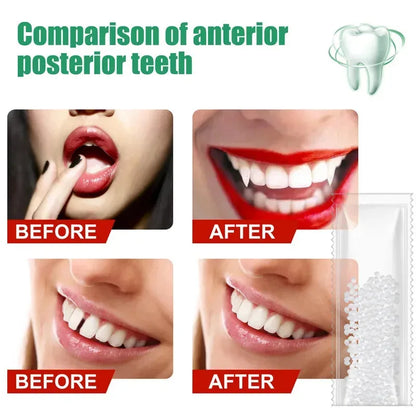 5-100g Moldable False Teeth Tooth Repair Granules Tooth Beads Temporary Filling For Rooth Broken Tooth Repair Kit Thermal Fit