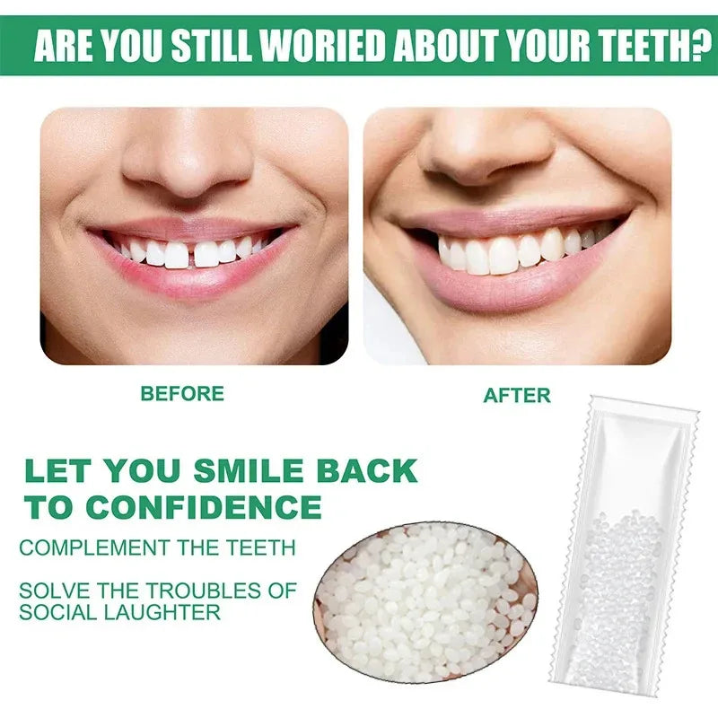5-100g Moldable False Teeth Tooth Repair Granules Tooth Beads Temporary Filling For Rooth Broken Tooth Repair Kit Thermal Fit