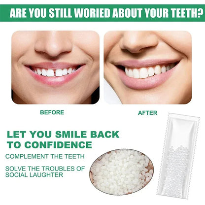 5-100g Moldable False Teeth Tooth Repair Granules Tooth Beads Temporary Filling For Rooth Broken Tooth Repair Kit Thermal Fit
