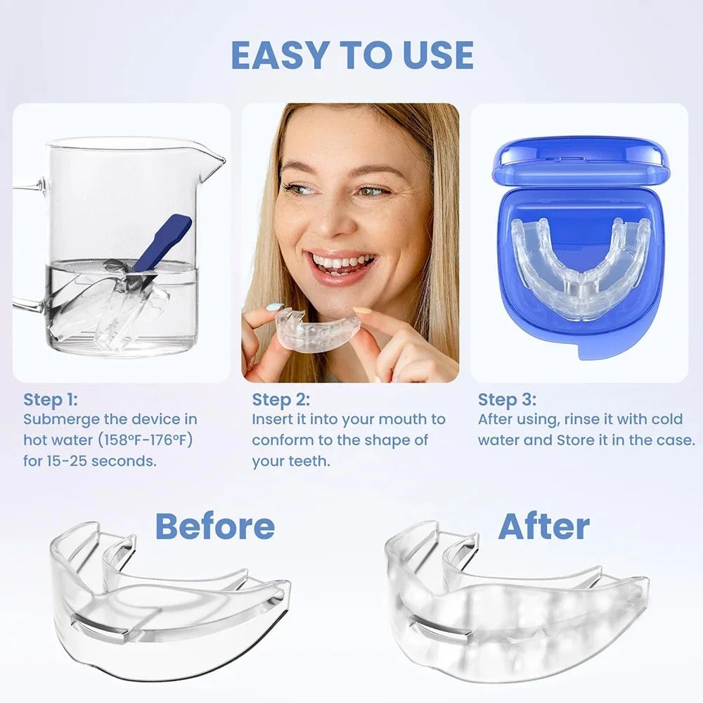 Anti Snoring Mouth Guard Anti Bruxism Teeth Grinding Sleep Aid Comfortable Night Sleep Breathing Protector For Reducing Snoring
