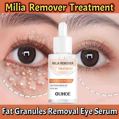 Fat Granules Removal Eye Serum Eye Milia Repair Treatment Products Wrinkle Lifting Moisturizing Anti-Puffiness Korean Skin Care
