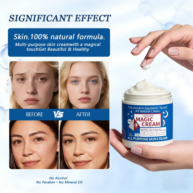 30g/60g/120g Magic Face Cream: Facial Moisturizing, Hydrating & Locks in Moisture & Deep Nourishing Formula for All Skin Types
