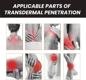 جل سم النحل لتهدئة آلام المفاصل والعضلات 20 جم امتصاص سريع ودعم راحة المفاصل